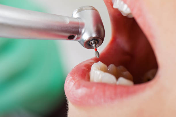 Best Emergency Dentist for Knocked-Out Tooth in Bellefonte, DE